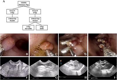 Standardized construction of a porcine model for acute obstructive jaundice and training of endoscopic ultrasound-guided choledochoduodenostomy